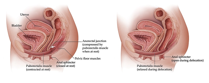 Treating patients with pelvic floor dysfunction - Mayo Clinic