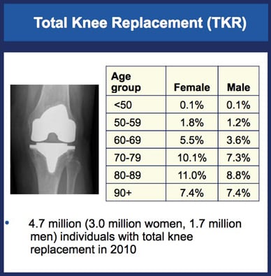 Chart showing prevalence of knees replaced