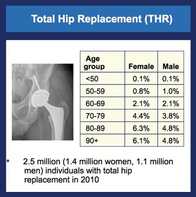 Chart showing prevalence of hips replaced