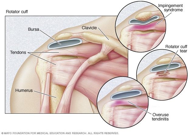 Anatomy And Injuries Of The Shoulder Chart