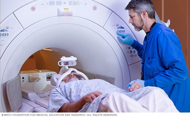 Imagen por resonancia magnética (IRM) del cerebro