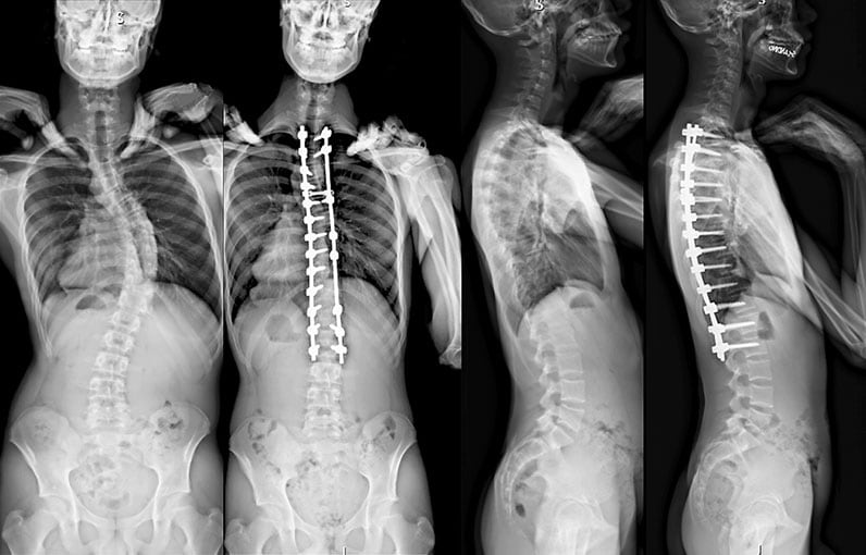 What To Look For In Spinal Surgery Professionals. Site Title