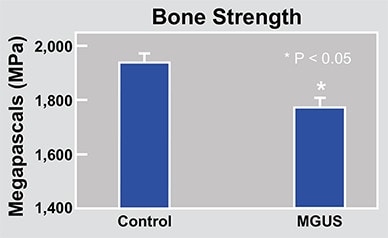 Chart of assessment of bone microarchitecture based on HRpQCT imaging