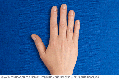 Thumb joint pain 2025 exercises