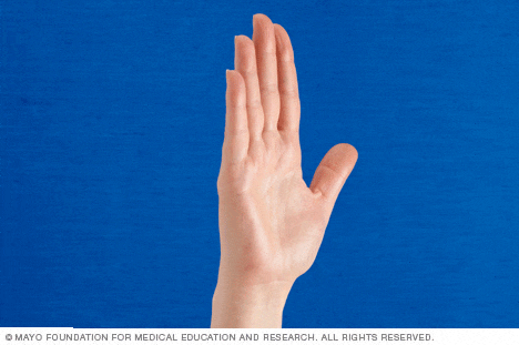 A veces a veces tema Muñeco de peluche Presentación de diapositivas: Ejercicios de manos para personas con  artritis - Mayo Clinic