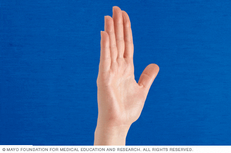 Exercises for stiff hands clearance