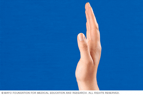 Ejercicios de manos para la artritis