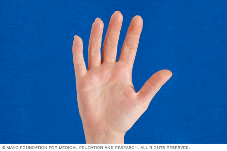 Slide Show Hand Exercises For People With Arthritis Mayo Clinic Slide Show Hand Exercises For People With Arthritis Mayo Clinic