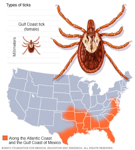 Guide to different tick species and the diseases they carry Mayo