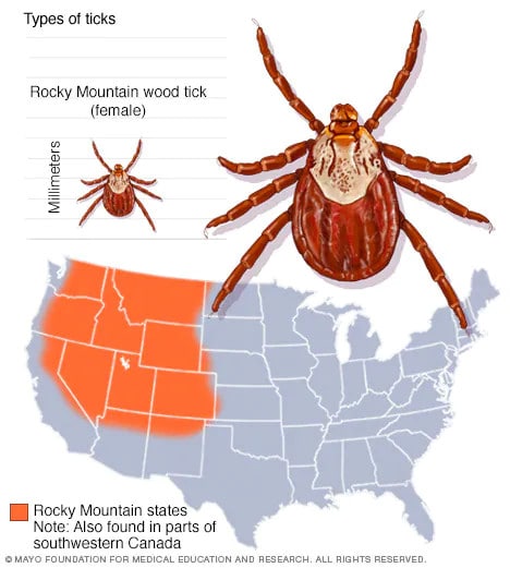 Rocky Mountain wood tick