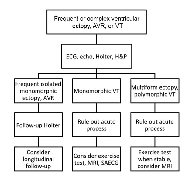 Pediatric ventricular arrhythmia evaluation