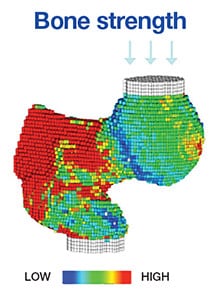 Process by which CT images are analyzed
