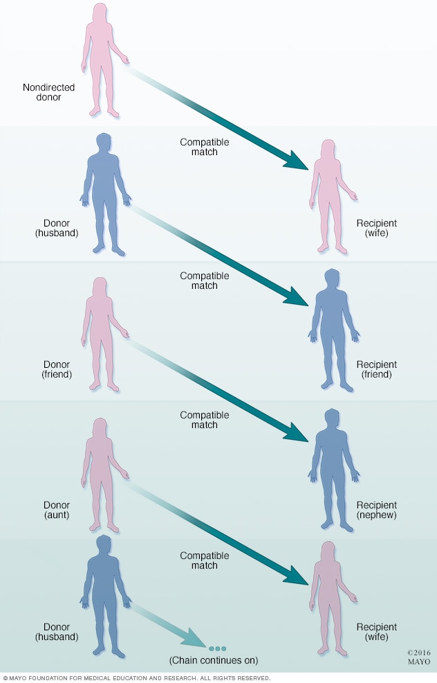 Blood Type Compatibility Chart For Kidney Transplant