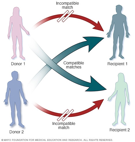 Blood Type Compatibility Chart For Kidney Transplant