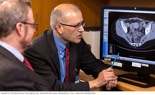 Doctors at Mayo Clinic research kidney transplant innovations to improve care.