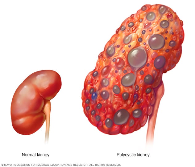 What are the signs of renal failure