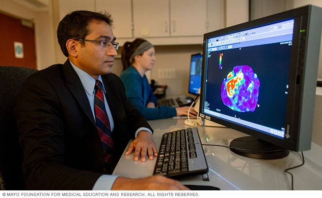 Un médico observa una elastografía por resonancia magnética