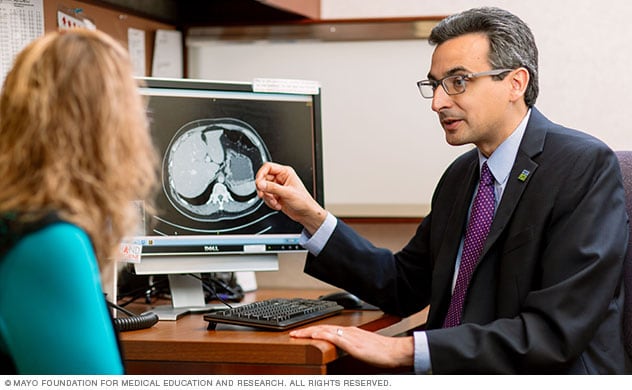Liver transplant consultation at Mayo Clinic