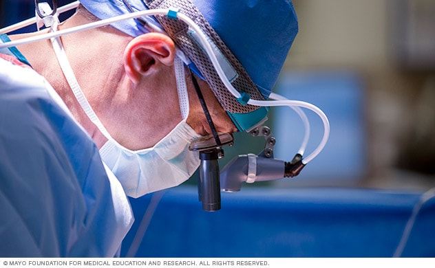 Lung transplant surgeons