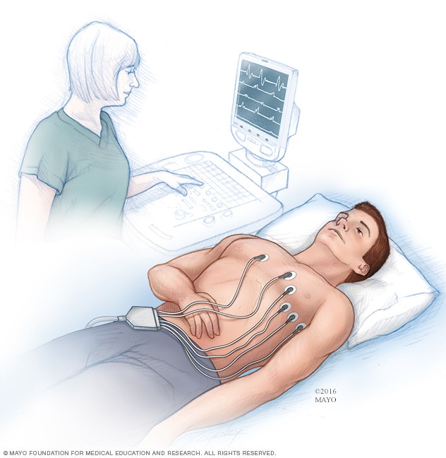 Electrocardiogram