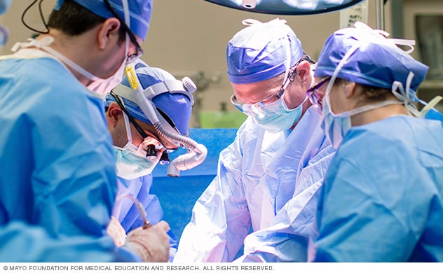 妙佑医疗国际的泌尿外科医生正在进行肾脏切除术。