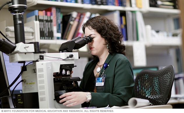 Kidney cancer Doctors and departments Mayo Clinic