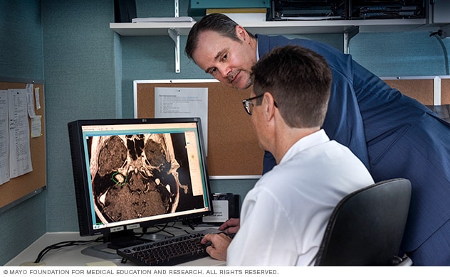 Stereotactic radiosurgery planning session for an acoustic neuroma