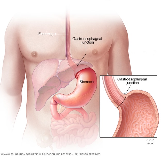 Abdominal cancer types