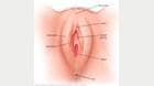 Illustration showing outer female genitalia (vulva)