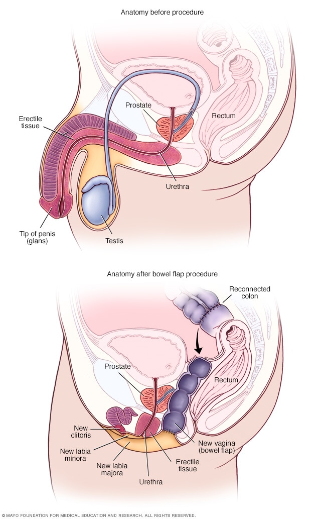 7 Things to Know About Transitioning, Hormones, and Breast Growth