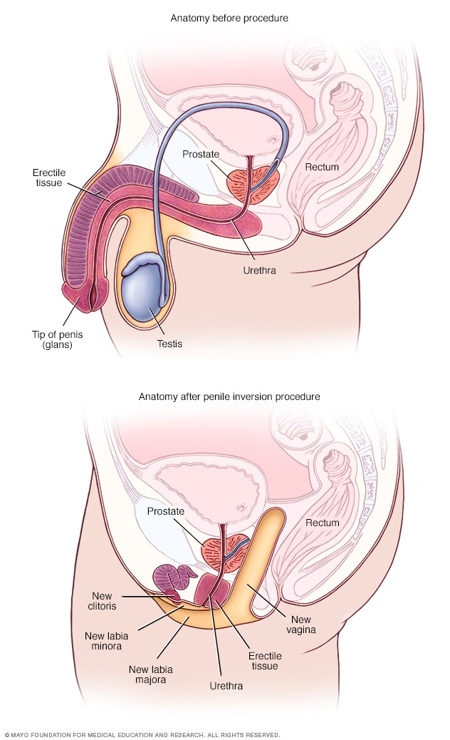 Vestibuli Et Vaginae