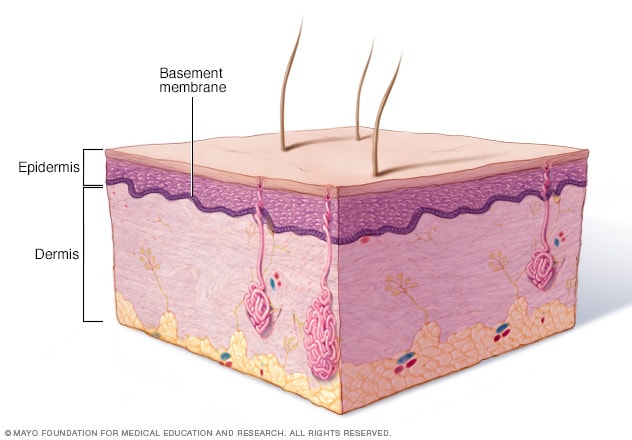 The basement membrane zone separates the outer and underlying layers of skin.