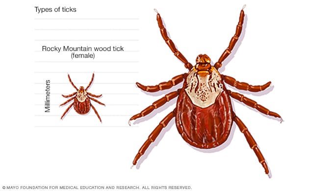 Photographs of dog tick, wood tick