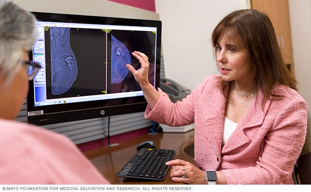 Un cirujano de cáncer de mama analiza las opciones con la paciente