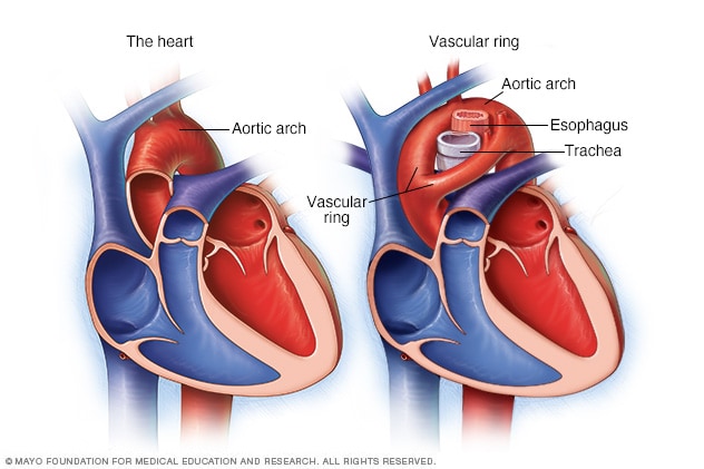 Fundraiser for Michelle Teate by Meghan Morrow : Travel & Medical fees for  Delilahs Heart Surgery