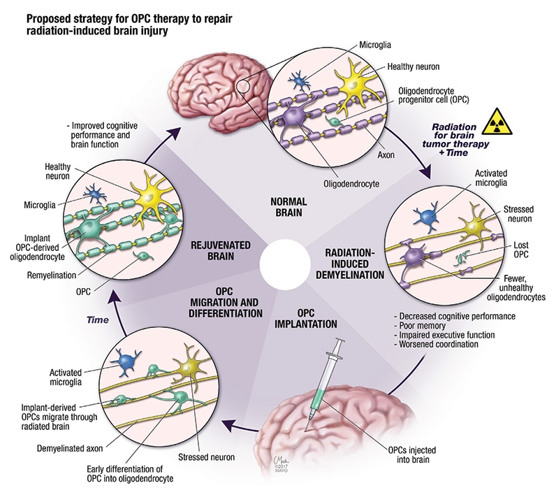 Regenerative medicine: Potential to improve life after ...