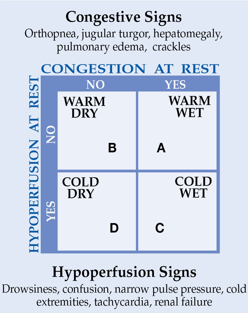 Hypoperfusion signs