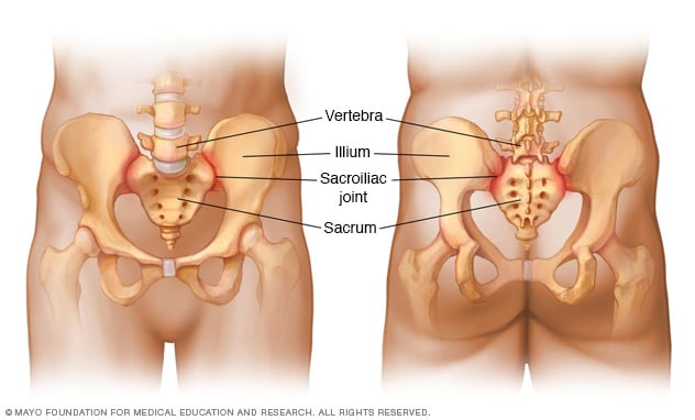 Sacroiliac joints shown