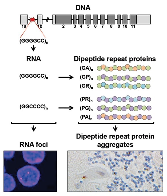 A noncoding repeat expansion in the C9orf72 gene that is the most common cause of ALS