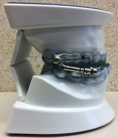 SomnoDent Herbst telescopic oral appliance