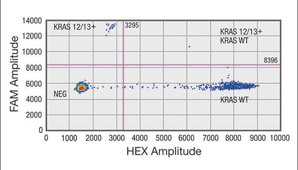 Droplet digital PCR (ddPCR) analysis of cell-free DNA (cfDNA) shows sample positive for a mutation in codon 12/13 in KRAS gene