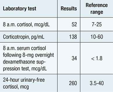 Evaluation confirming adrenocorticotropic hormone-dependent Cushing syndrome
