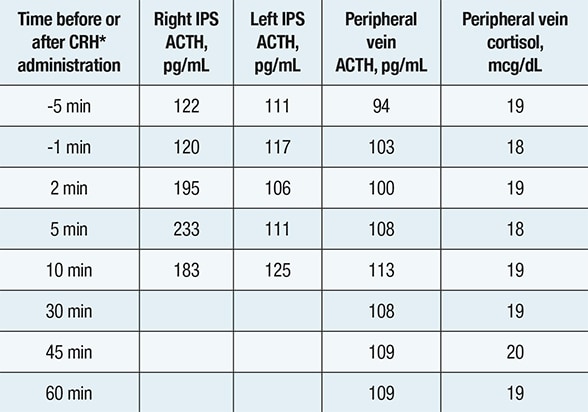 Inferior petrosal sinus (IPS) sampling