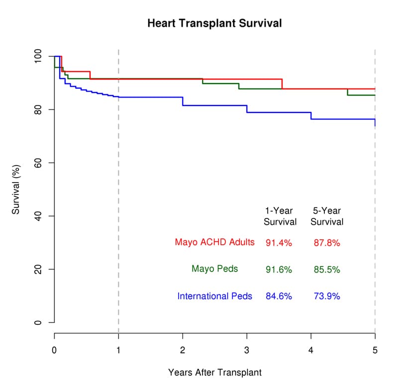 Pediatric heart transplant 1982-2017 outcomes