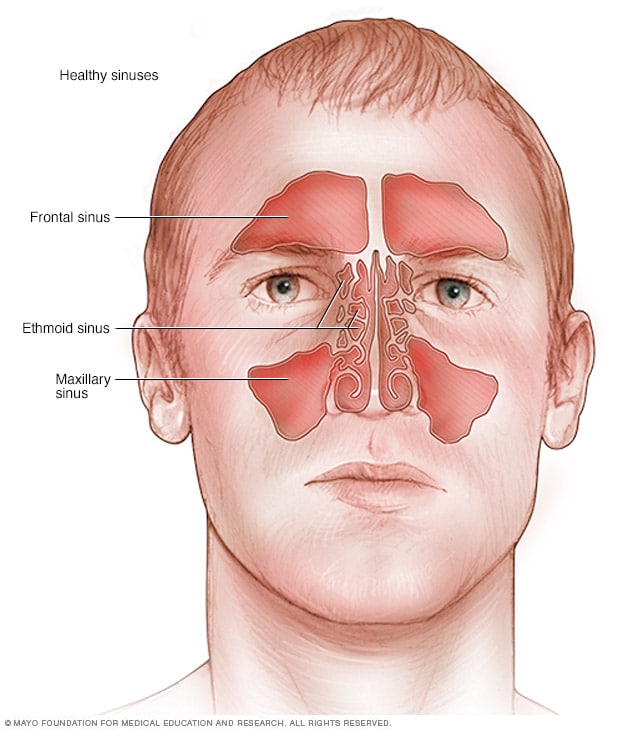Acute sinusitis - Symptoms and causes - Mayo Clinic