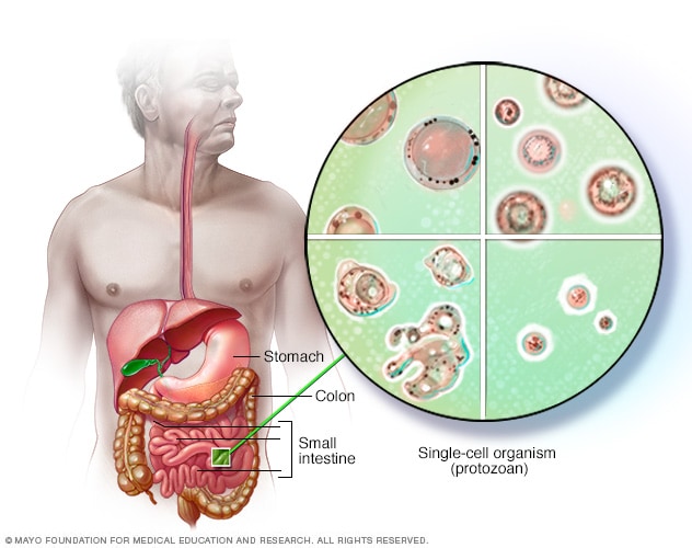 bél paraziták blastocystis hominis