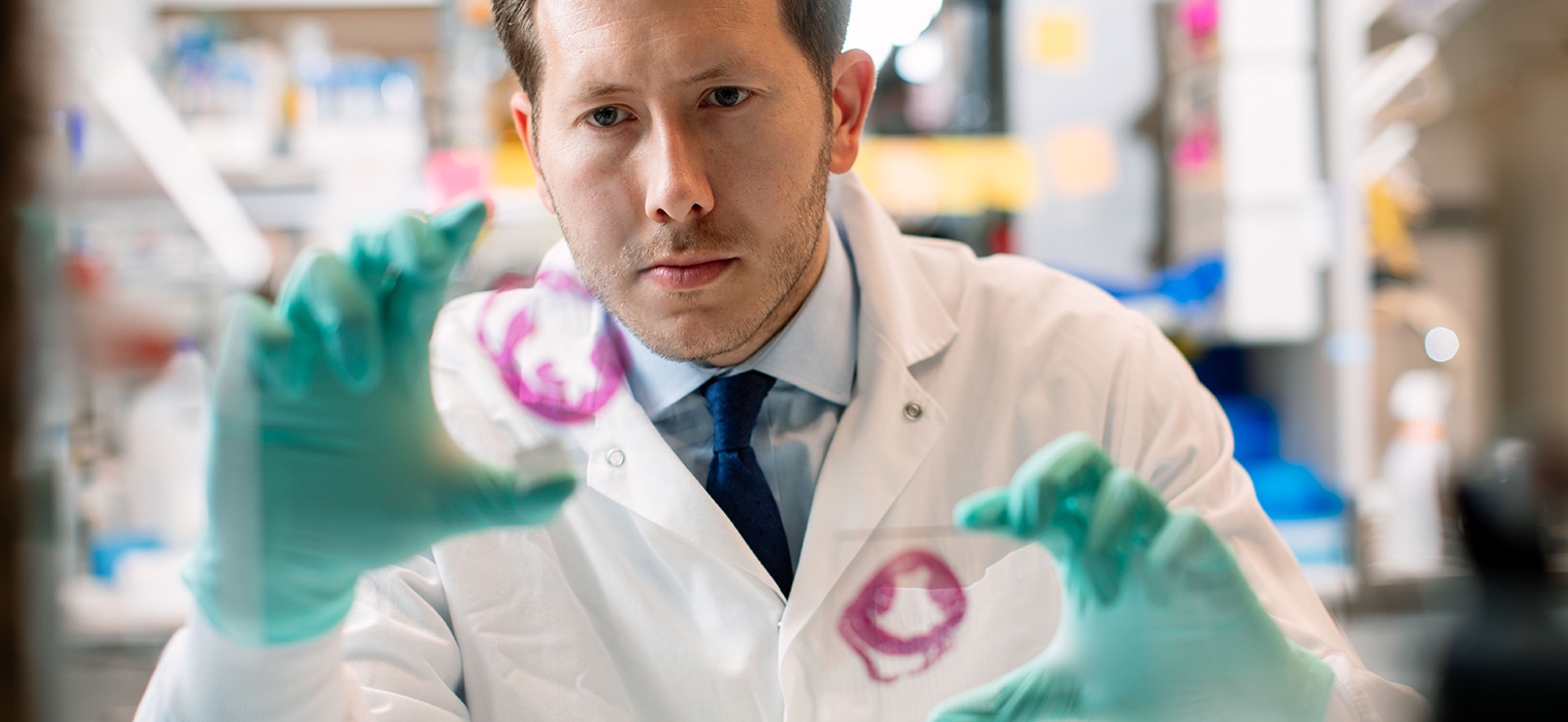 Is Mayo Clinic doing research on my condition? - Mayo Clinic