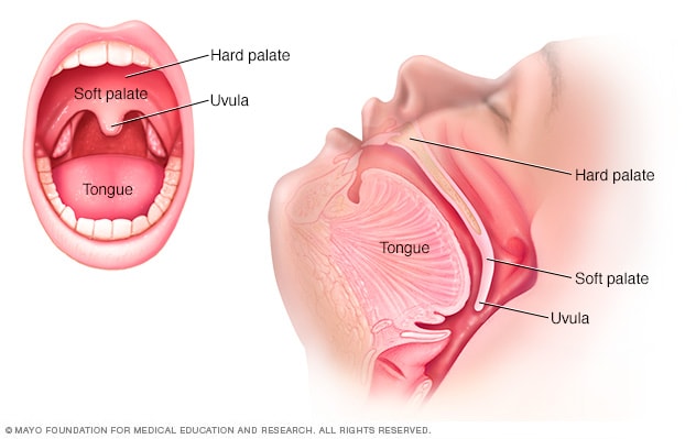 makker under Korn Soft palate cancer - Symptoms and causes - Mayo Clinic