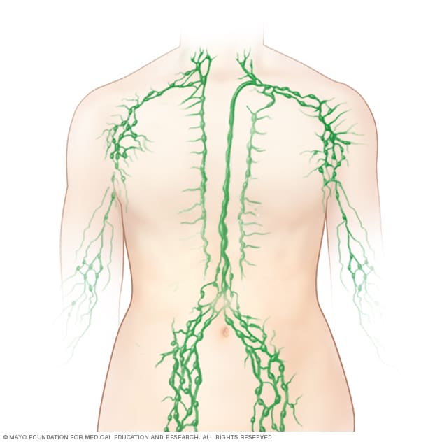 Swollen remedies lymph nodes for How to