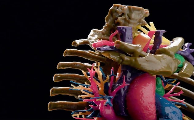 Laboratorios de modelado anatómico tridimensional - Panorama general - Mayo  Clinic